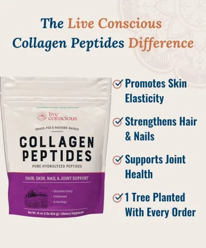 Collagen Peptides Powder - Naturally-Sourced Hydrolyzed Collagen Powder - Hair, Skin, Nail, and Joint Support - Type I & III Grass-Fed Collagen Supplements for Women and Men - 41 Servings - 16oz