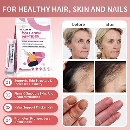 NATURE TARGET,Multi Collagen Peptides Powder - Type I, II, III, V, X - Enhanced Absorption, Hydrolyzed Collagen Peptides with Prebiotics, Sugar-Free, Skin Hair Nail & Joint Support, Non-GMO