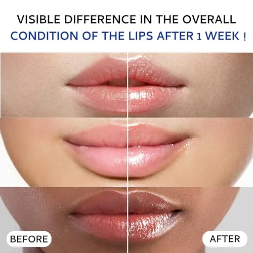 Tobcharm Lip Sleeping Mask(20g), Lip Collagen, Lip Mask Overnight, Lip Plumper Advanced with Hyaluronic Acid, Lip Balm With Peptide Complex For Lip Wrinkles Repair Overnight Lip Masks